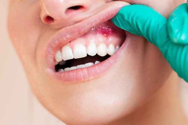 Types Of Gum Disease Treatment